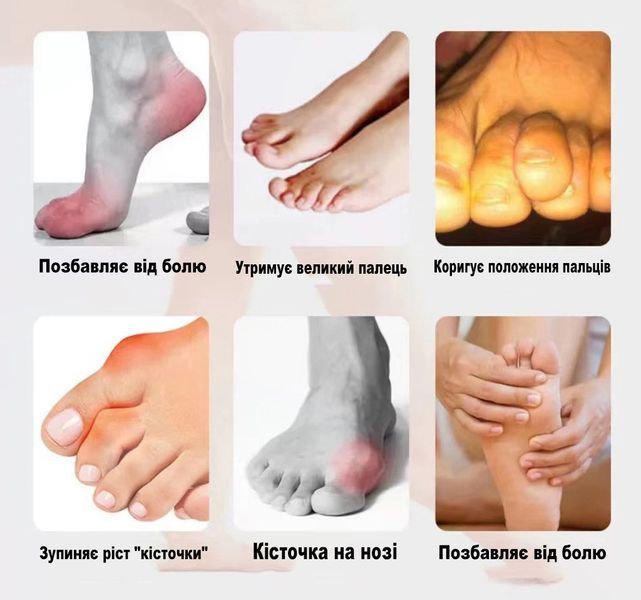 Фіксатор для пальця ноги. Подвійний гельовий фіксатор. Коректори для кісточки великого пальця 9146-670119 9146 фото